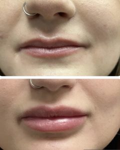 19922D10-BC22-48FA-A0D9-D3D20AA6A460