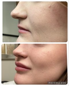 B28BBBC0-D49F-44B2-8262-7EAC7A49D63F